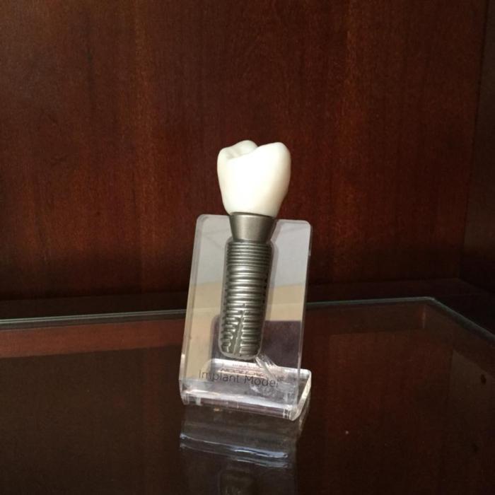 dental implant | Hermitage, PA | Thomas Family Dentistry