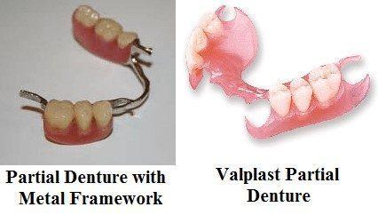 A collage of partial dentures in Hermitage, PA