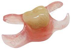 A partial denture in Hermitage, PA
