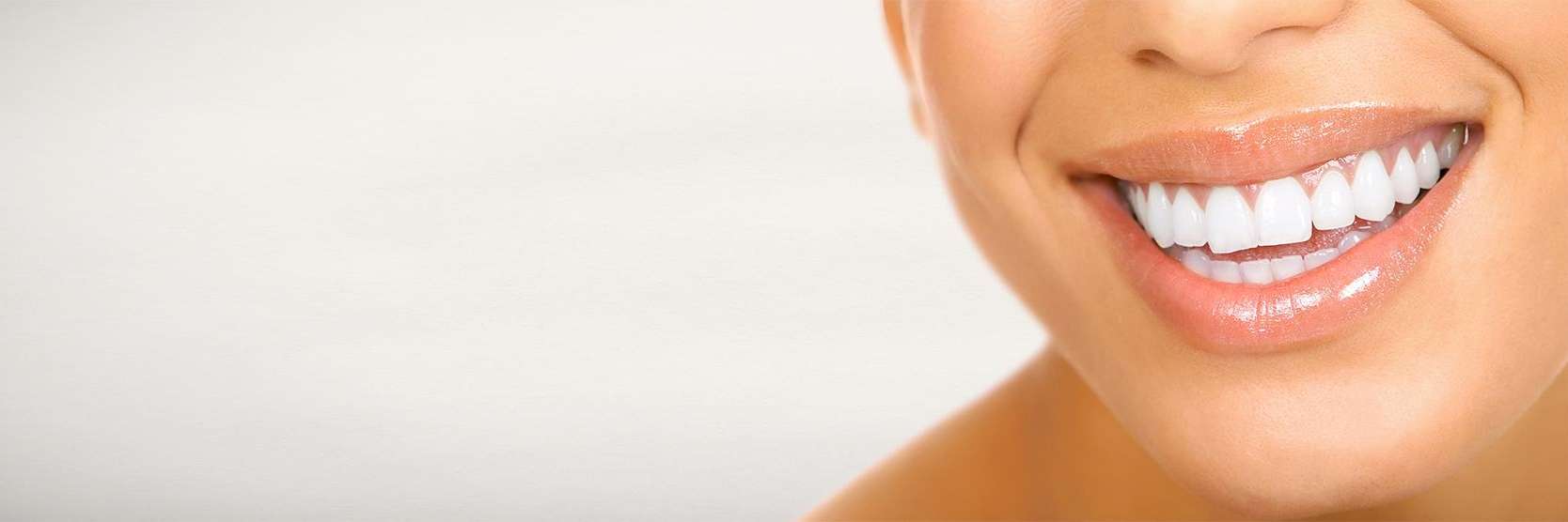 Lady's teeth after professional whitening in Hermitage, PA
