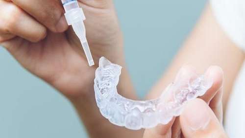 Hand holding clear aligners in Hermitage, PA