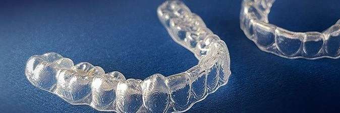 Retainers | Dentist